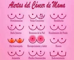 cáncer mama